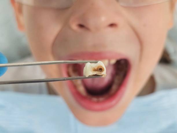 Best Knocked-Out Tooth Emergency  in Pike Road, AL